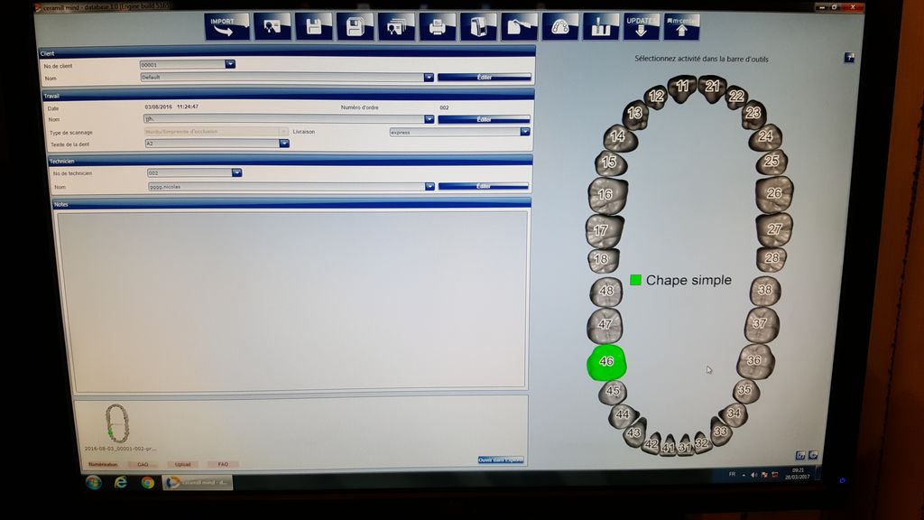 http://www.iproweb.fr/test/3%20-%20AU%20SOL/AMANN%20GIRRBACH%20-%20Ceramill%20Map300/20170327_172656c.jpg