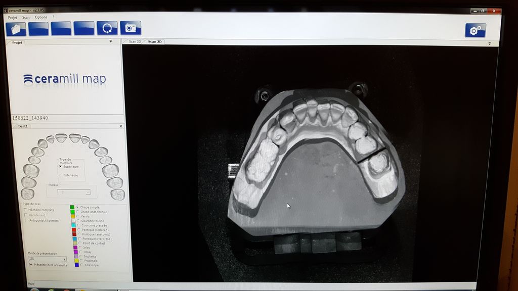 http://www.iproweb.fr/test/3%20-%20AU%20SOL/AMANN%20GIRRBACH%20-%20Ceramill%20Map300/20170327_172742g.jpg